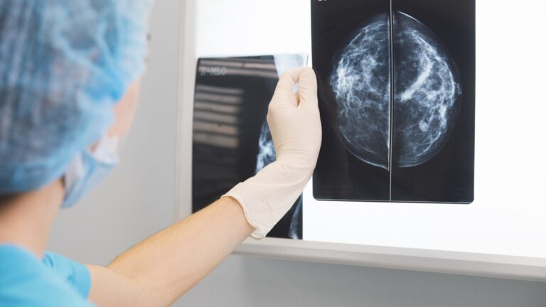 Relay Scores Early Breast Cancer Win, Plans Pivotal Trial Against AstraZeneca’s Truqap