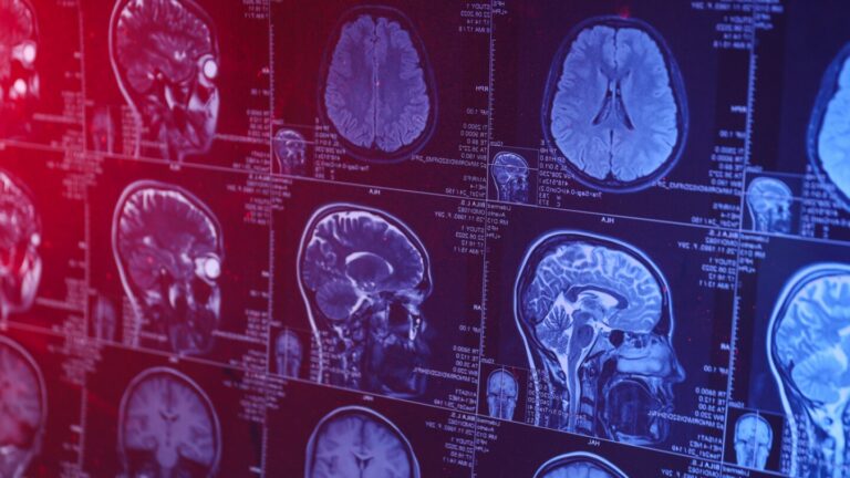 The Latest Surge in Neuroscience Exploration