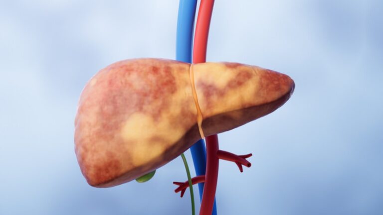 Focus Shifts to Vertex’s Kidney Division as Journavx Painkiller Surpasses 500,000 Prescriptions