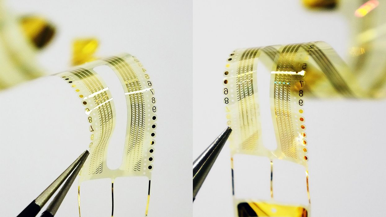 Is It Possible for Electrical Stimulation to Regain Vision?