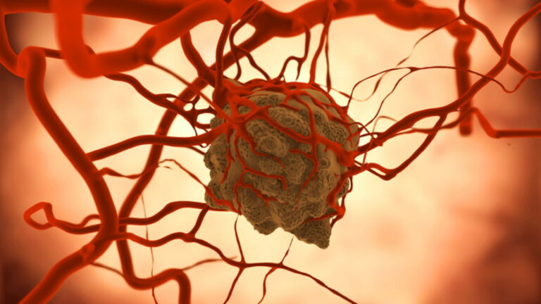 Exploring the Untapped Potential of PD-(L)1×VEGF Bispecific Agents Beyond Lung Cancer