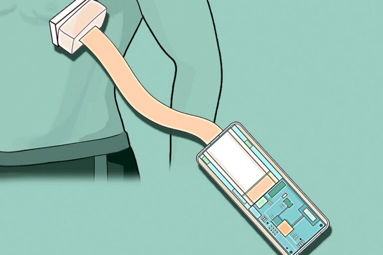 Future Pacemakers May Emerge from Innovative Ultrasound Patch Technology