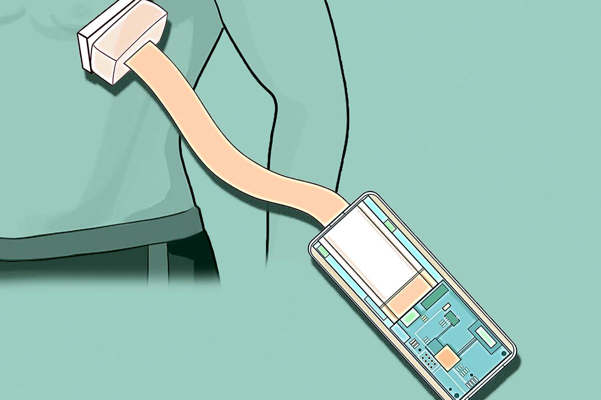 Future Pacemakers May Emerge from Innovative Ultrasound Patch Technology